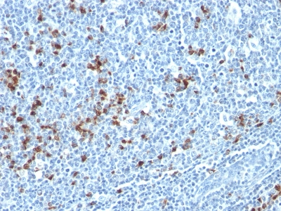 Formalin-fixed, paraffin embedded human tonsil sections stained with 100 ul anti-Kappa Light Chain (clone HP6053 + L1C1) at 1:400. HIER epitope retrieval prior to staining was performed in 10mM Citrate, pH 6.0.